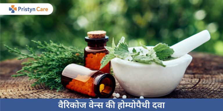 homeopathy-medicines-for-varicose-veins-in-hindi