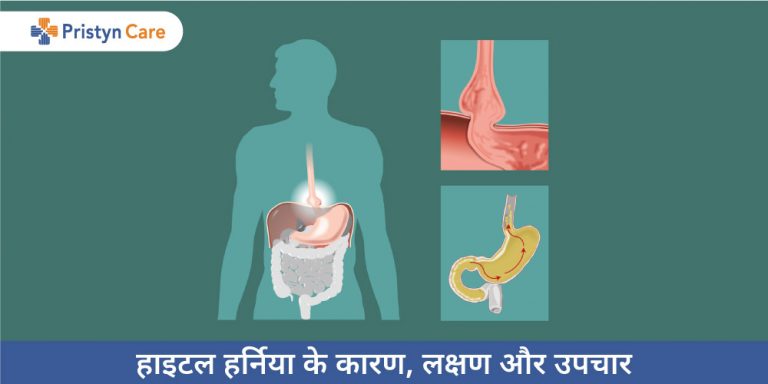 Hiatal hernia in Hindi