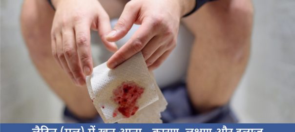 लैट्रिन (मल) में खून आना – कारण, लक्षण और इलाज । latrine me blood aana in hindi