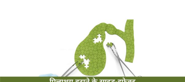 पित्ताशय (पित्त की थैली) हटाने के साइड इफेक्ट – Side-effects of Gall Bladder removal in Hindi