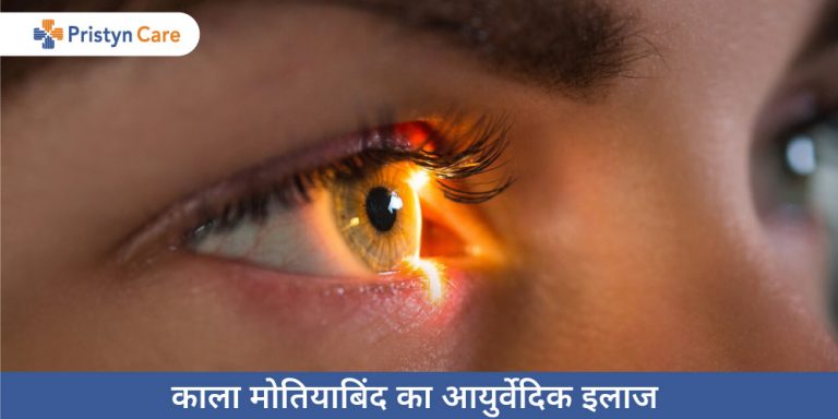 ayurvedic-treatment-of-glaucoma-in-hindi