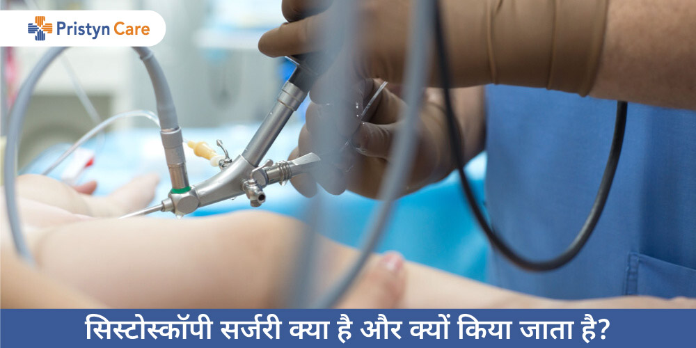 cystoscopy-surgery-in-hindi