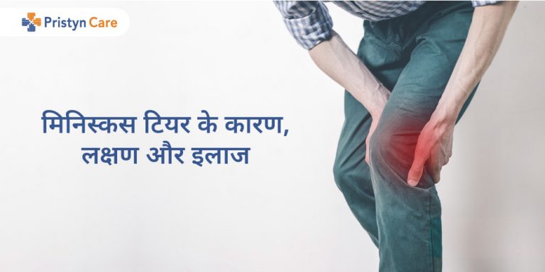 meniscus-tear-in-hindi