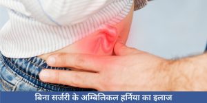 बिना सर्जरी अम्बिलिकल हर्निया का इलाज
