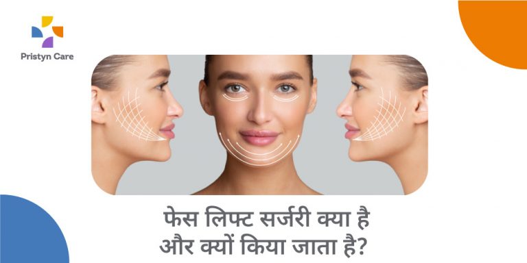 facelift-meaning-in-hindi