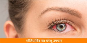 home-remedies-for-cataract-in-hindi