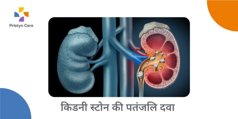 patanjali-medicine-for-kidney-stone-in-hindi