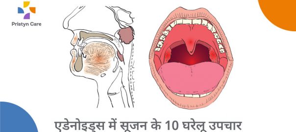 एडेनोइड्स में सूजन के 10 घरेलू उपाय