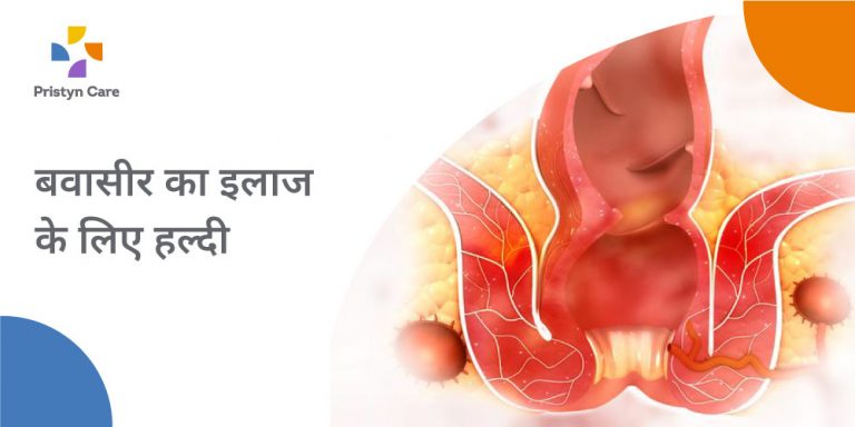 बवासीर का इलाज के लिए हल्दी