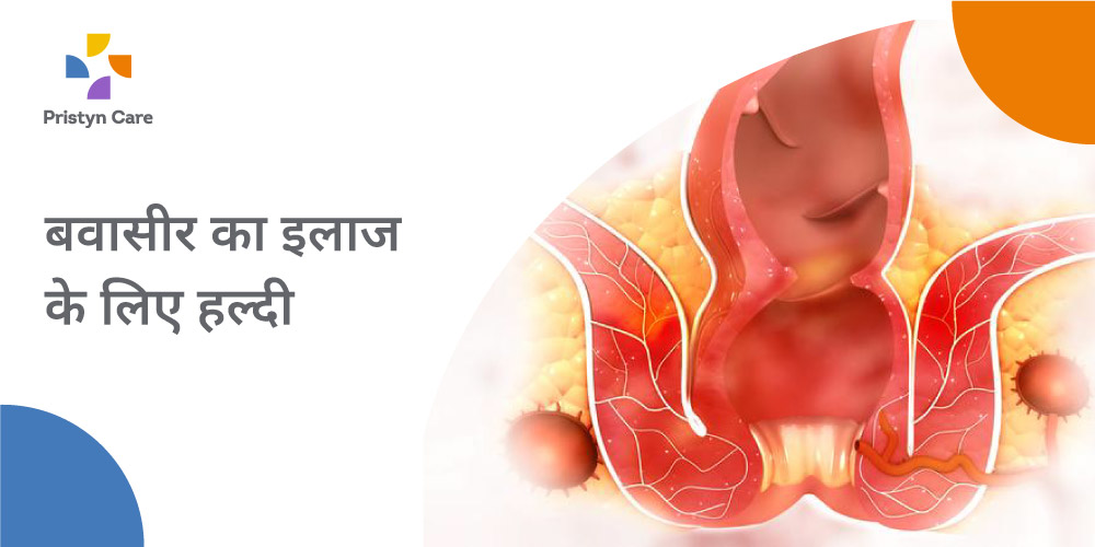 बवासीर का इलाज के लिए हल्दी