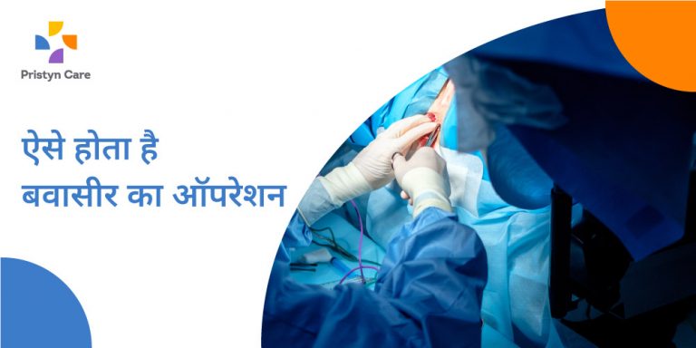 बवासीर के सर्जरी कैसे की जाती है