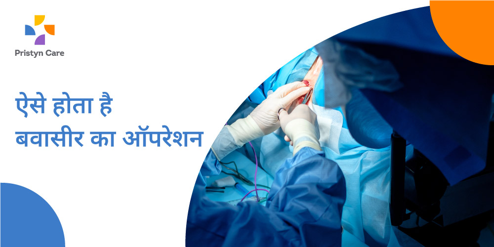 ऐसे होती है बवासीर का ऑपरेशन की प्रक्रिया Bawaseer ka operation kaise hota hai Pristyn Care