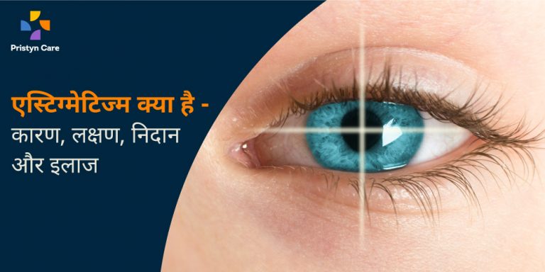 causes-symptoms-and-treatment-of-astigmatism-in-hindi