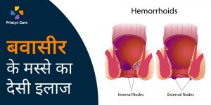 bawasir ke masse ka desi upchar