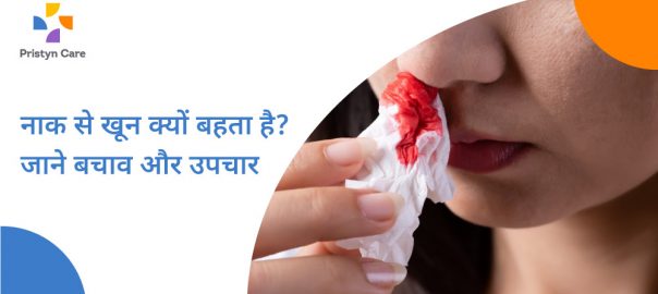 नाक से खून क्यों बहता है? जाने बचाव और इलाज