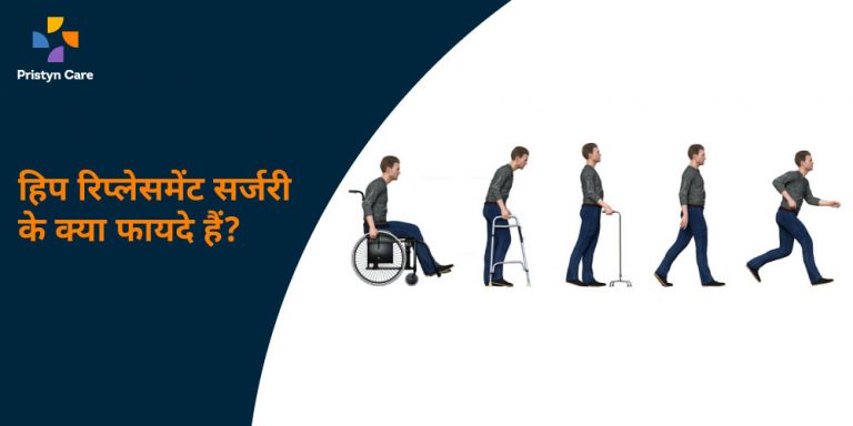 benefits-of-hip-replacement-surgery-in-hindi