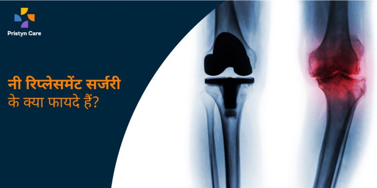 benefits-of-knee-replacement-surgery-in-hindi