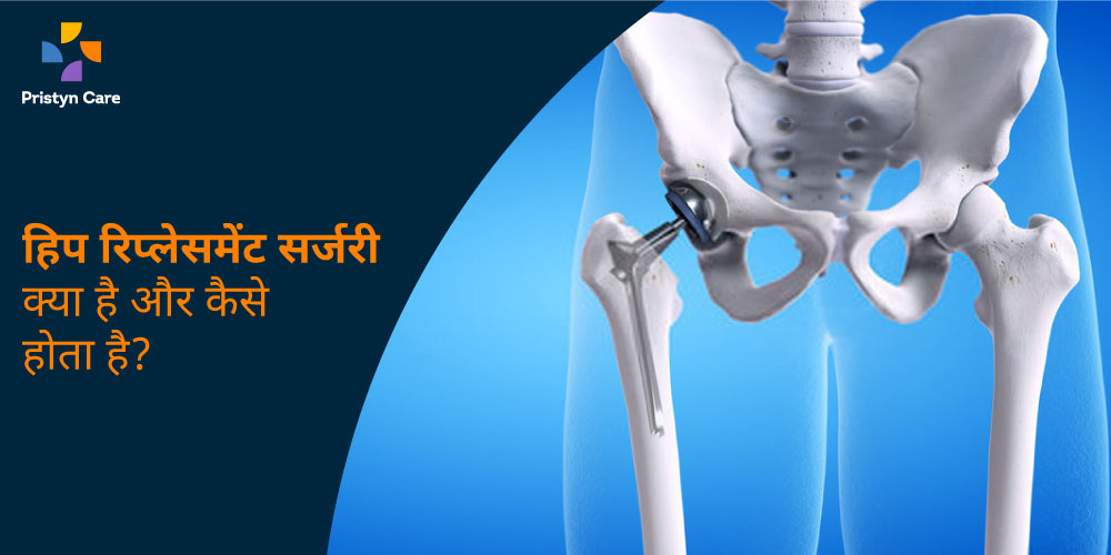 hip-replacement-surgery-kya-hai-kaise-hota-hai