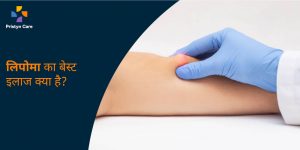 lipoma-best-treatment-in-hindi