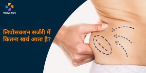 liposuction-surgery-cost-in-hindi