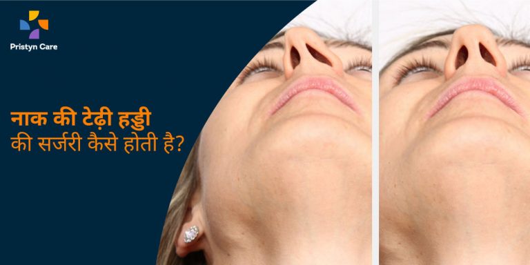 septoplasty-procedure-in-hindi
