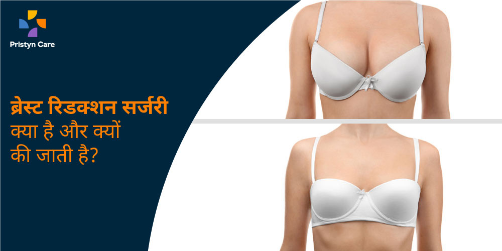 what-is-breast-reduction-surgery-why-is-it-done-in-hindi
