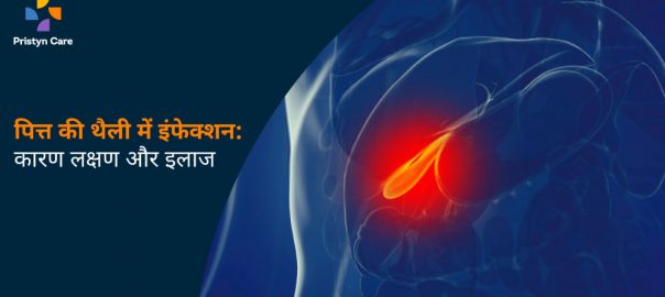 पित्त की थैली में इन्फेक्शन: कारण, लक्षण और उपचार – Gallbladder infection in Hindi
