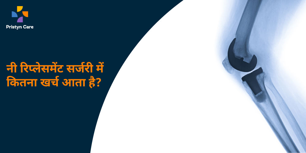 knee-replacement-surgery-cost-in-hindi