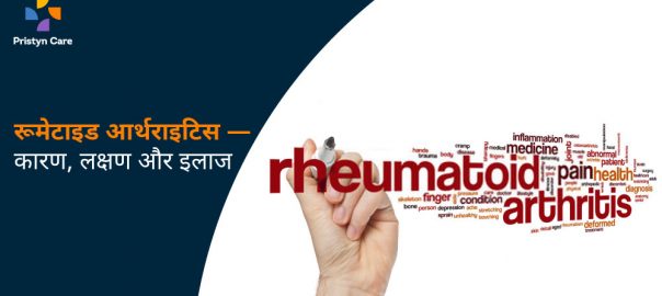 रूमेटाइड आर्थराइटिस का कारण, लक्षण, निदान और इलाज — Rheumatoid Arthritis In Hindi 