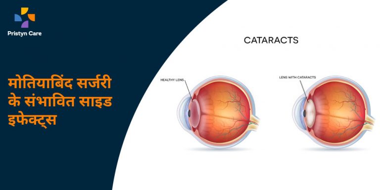 side-effects-of-cataract-surgery-in-hindi