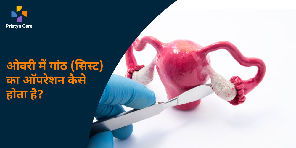 ovarian cyst (gaanth) ka operation kaise hota hai in hindi