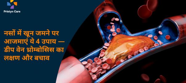 नसों में खून जमने पर आजमाएं ये 4 उपाय — डीप वेन थ्रोम्बोसिस का लक्षण और बचाव