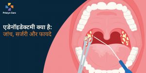 adenoidectomy-kya-hai-procedure-aur-faayde