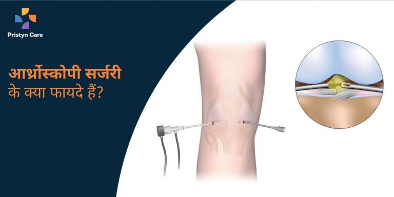 arthroscopy-surgery-ke-kya-fayde-hain