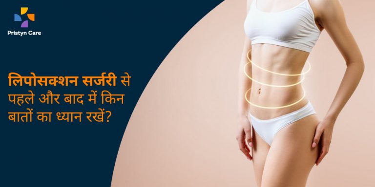 liposuction-surgery-before-and-after-in-hindi