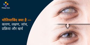 motiyabind-kya-hai-kaaran-lakshan-jaanch-prakriya-aur-kharch