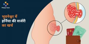 भुवनेश्वर-में-हर्निया-की-सर्जरी-का-खर्च