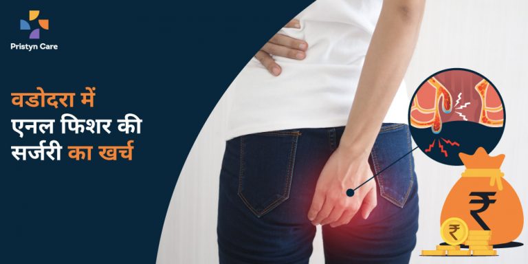 वडोदरा में एनल फिशर की सर्जरी का खर्च
