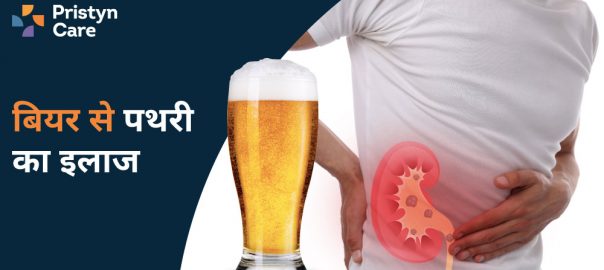 बियर से पथरी का इलाज