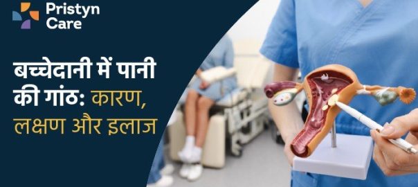बच्चेदानी में पानी की गांठ: कारण, लक्षण और इलाज