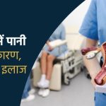 बच्चेदानी में पानी की गांठ