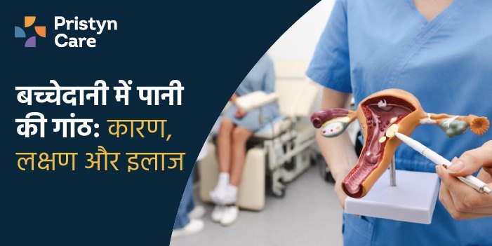 बच्चेदानी में पानी की गांठ