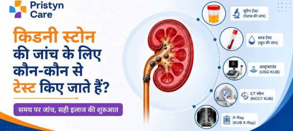 किडनी स्टोन की जांच के लिए कौन-कौन से टेस्ट किए जाते हैं?