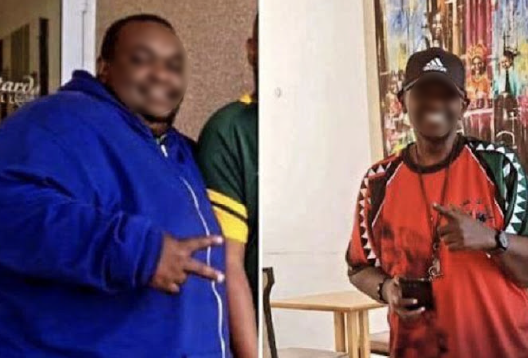 Before and After Image of a Patient undergone Bariatric Surgery - 2