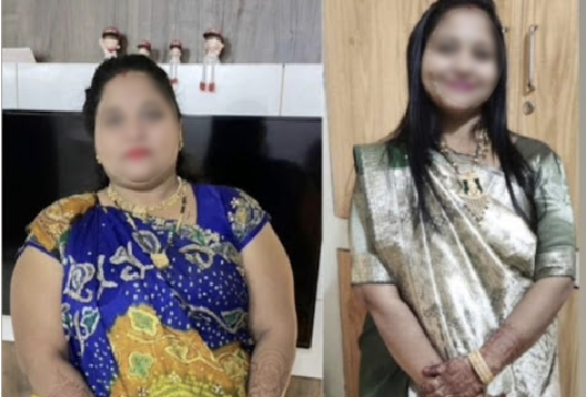 Before and After Image of a Patient undergone Bariatric Surgery - 2
