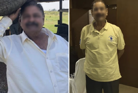 Before and After Image of a Patient undergone Bariatric Surgery - 3