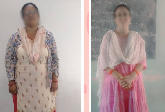 Before and After Image of a Patient undergone Bariatric Surgery - 4