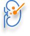 PCNL