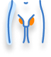 Varicocele