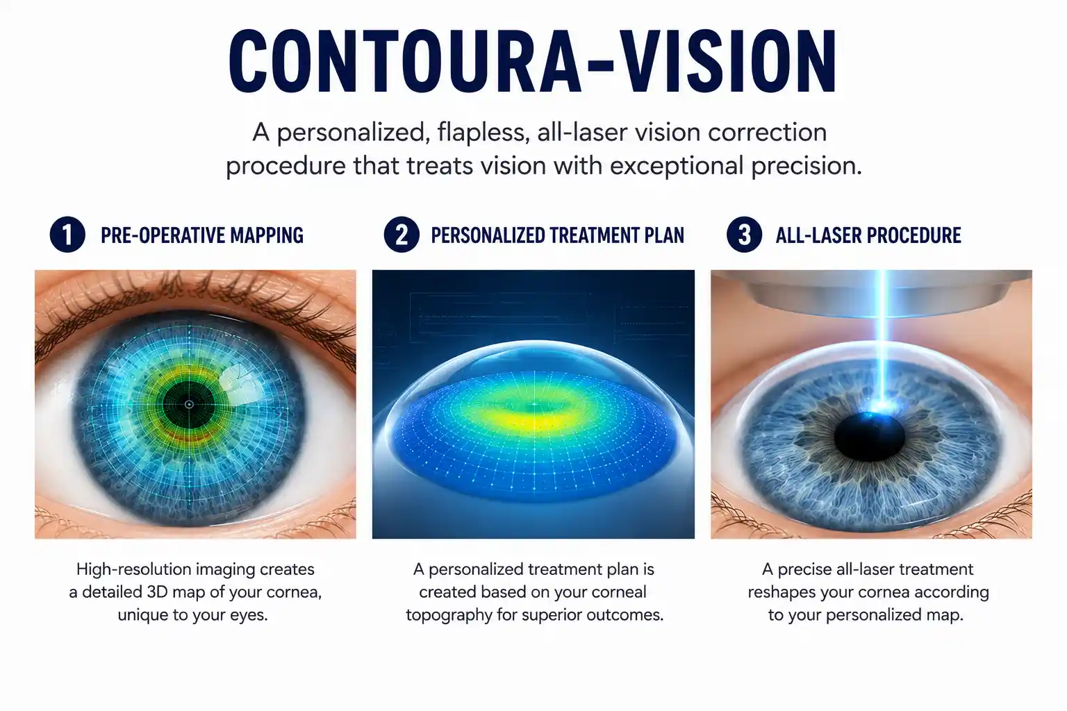 Contoura-Vision